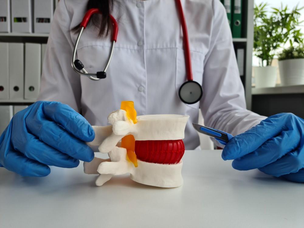 Who Is Not a Candidate for Artificial Disc Replacement?